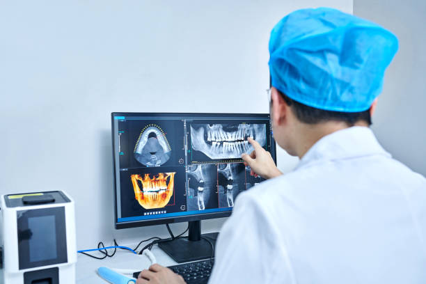 Best Emergency Wisdom Teeth Removal in Santa Paula, CA